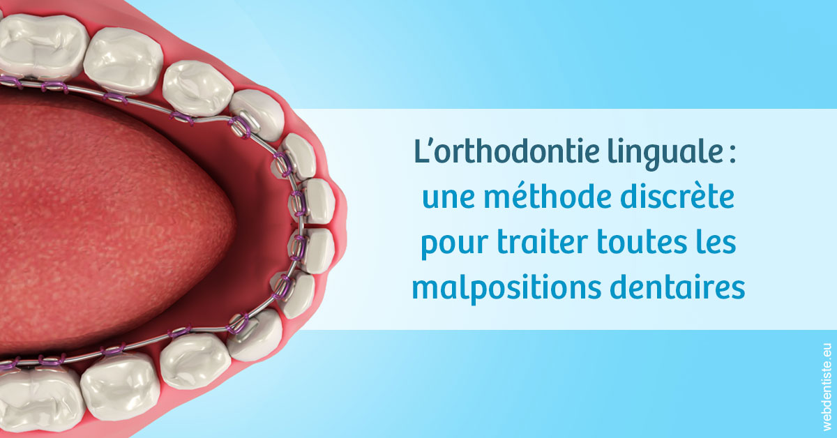 https://dr-lequart-christophe-frederic.chirurgiens-dentistes.fr/L'orthodontie linguale 1