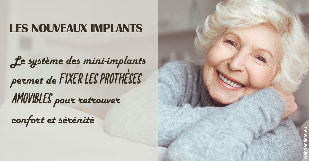 https://dr-lequart-christophe-frederic.chirurgiens-dentistes.fr/Les nouveaux implants 1