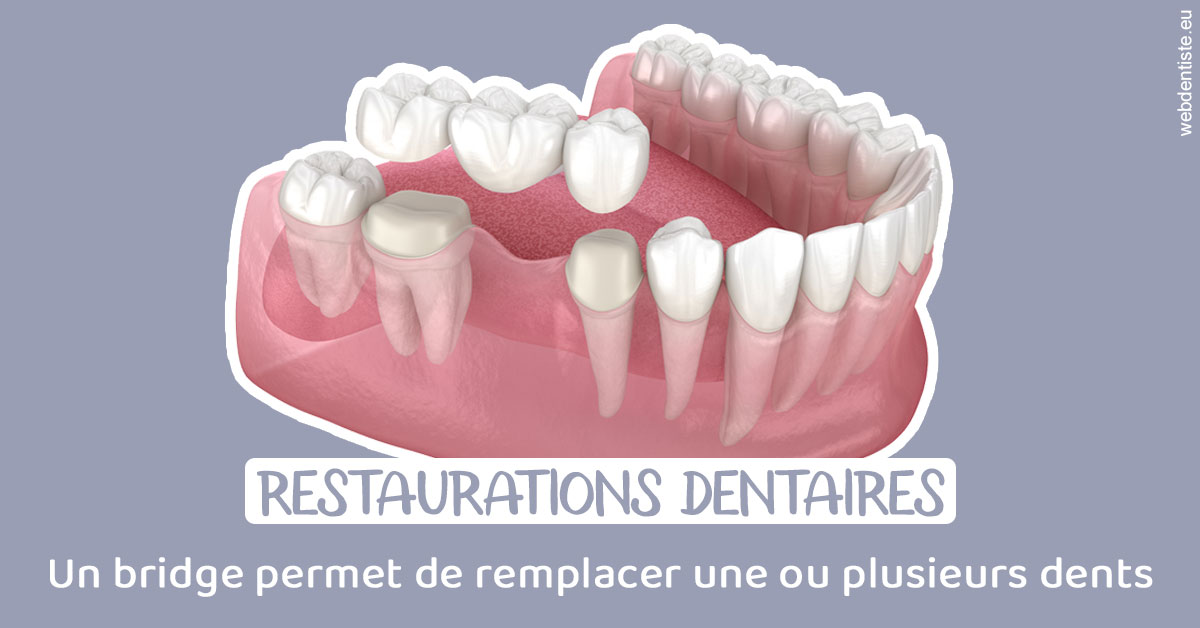 https://dr-lequart-christophe-frederic.chirurgiens-dentistes.fr/Bridge remplacer dents 1