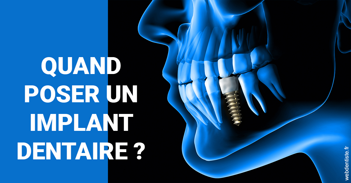 https://dr-lequart-christophe-frederic.chirurgiens-dentistes.fr/Les implants 1