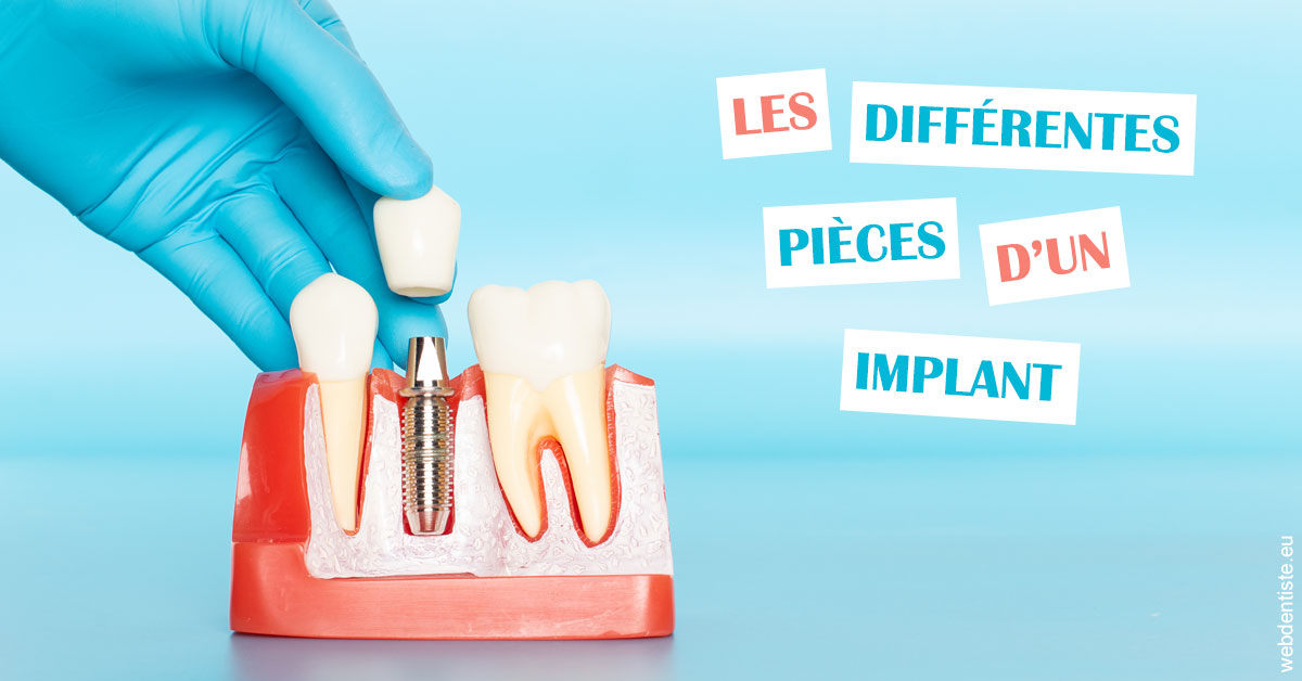 https://dr-lequart-christophe-frederic.chirurgiens-dentistes.fr/Les différentes pièces d’un implant 2