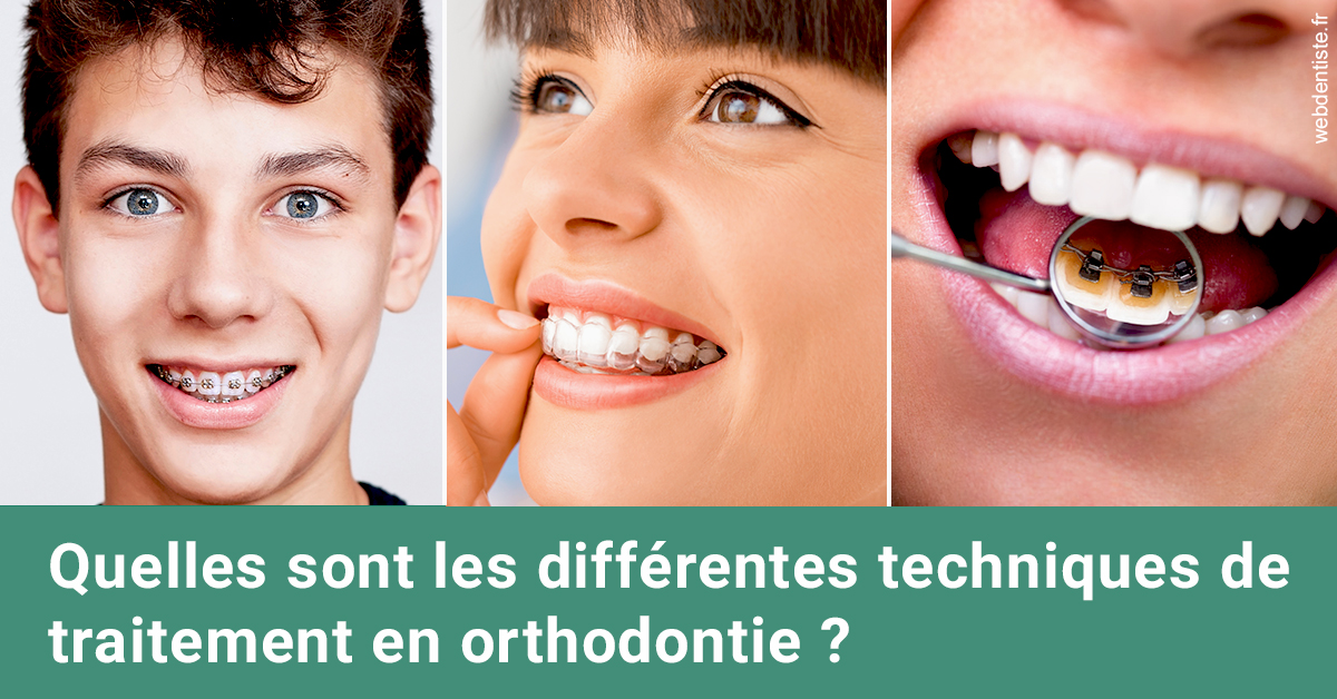https://dr-lequart-christophe-frederic.chirurgiens-dentistes.fr/Les différentes techniques de traitement 2