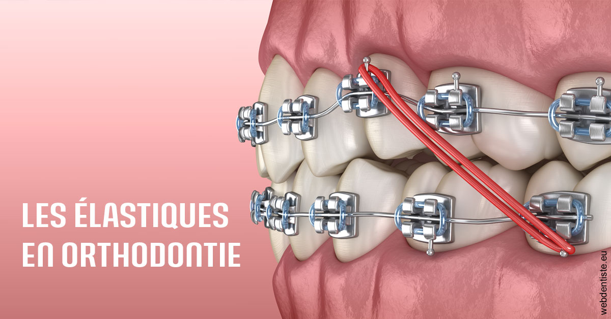 https://dr-lequart-christophe-frederic.chirurgiens-dentistes.fr/Elastiques orthodontie 2