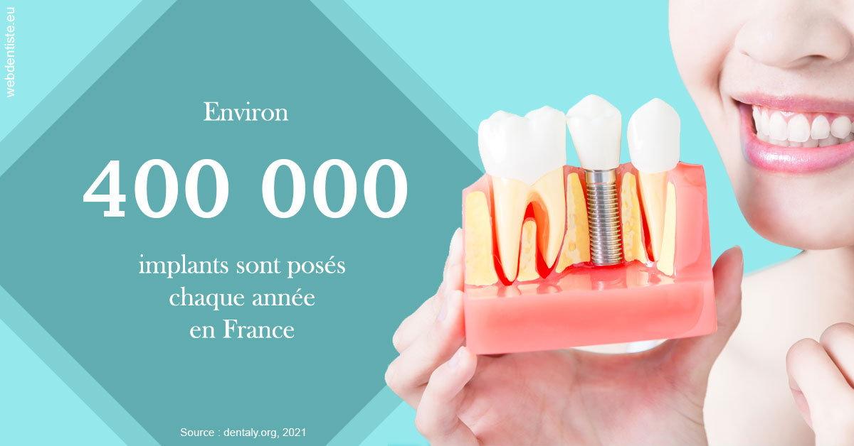 https://dr-lequart-christophe-frederic.chirurgiens-dentistes.fr/Pose d'implants en France 2