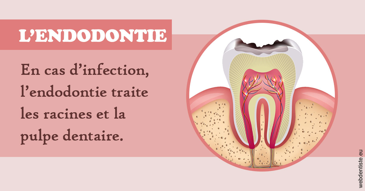 https://dr-lequart-christophe-frederic.chirurgiens-dentistes.fr/L'endodontie 2